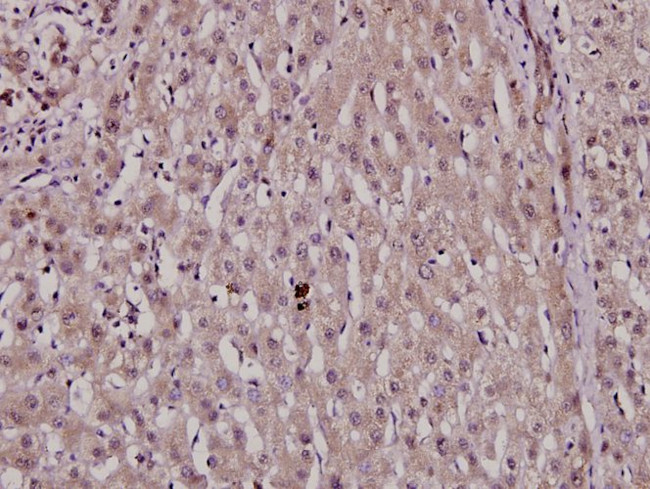 Phospho-HNF4A (Ser313) Antibody in Immunohistochemistry (Paraffin) (IHC (P))