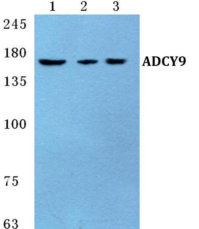 Adenylate Cyclase 9 Antibody in Western Blot (WB)