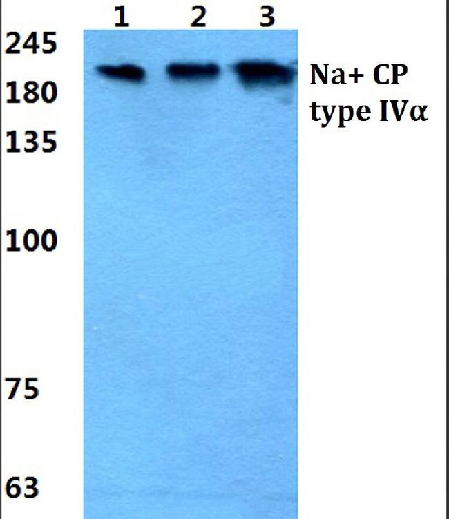 SCN4A Antibody in Western Blot (WB)