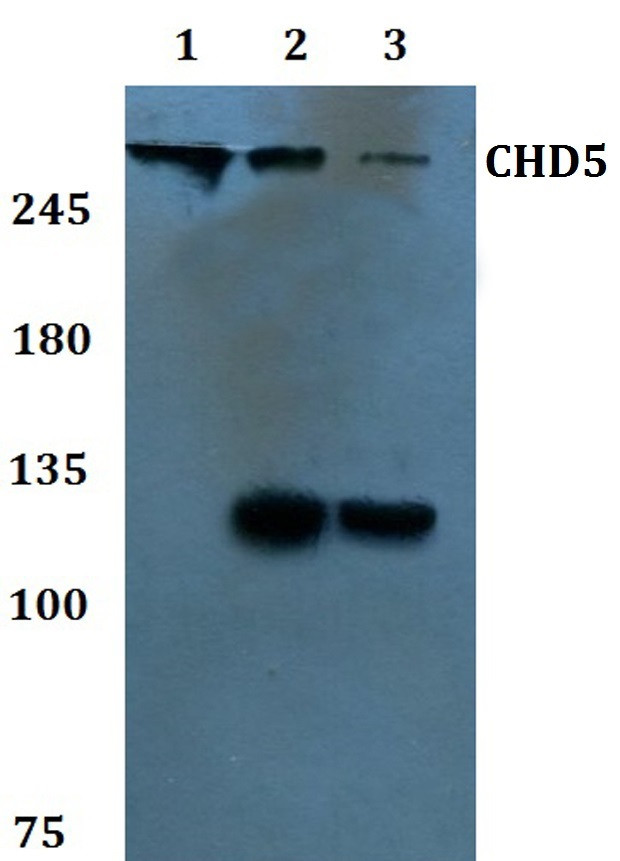 CHD5 Antibody in Western Blot (WB)