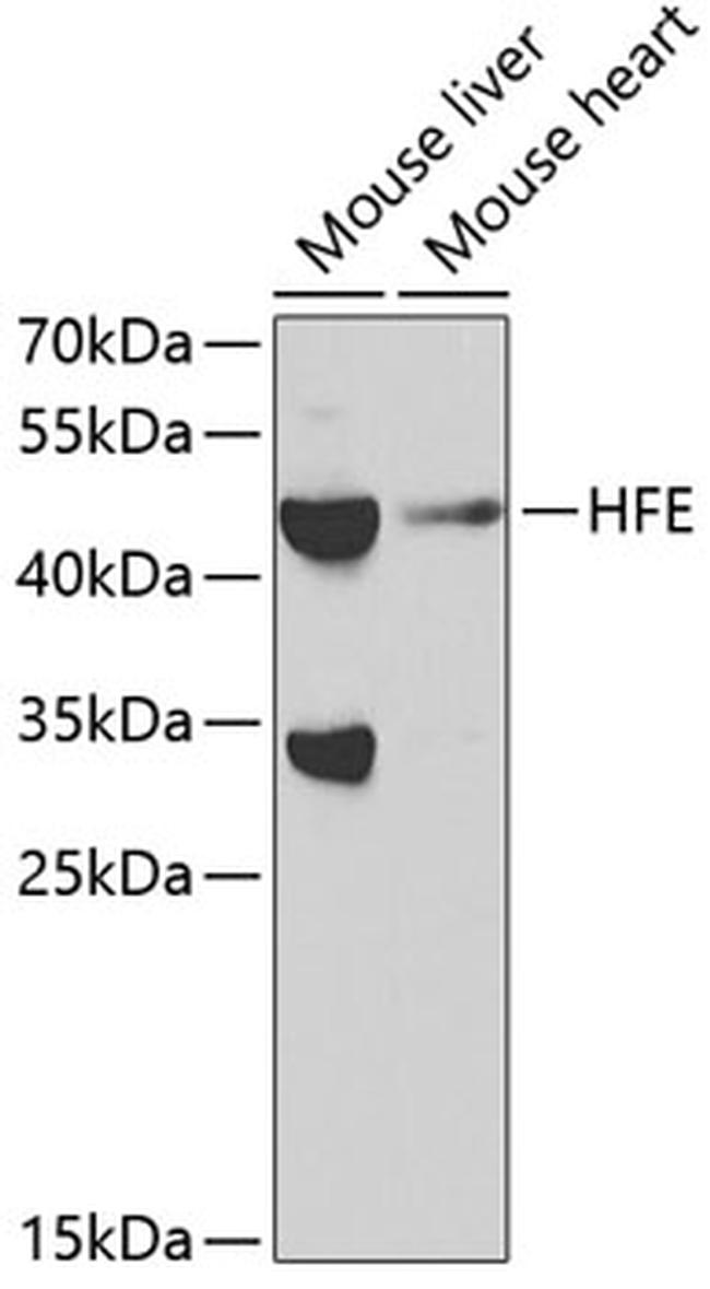 HFE Antibody in Western Blot (WB)