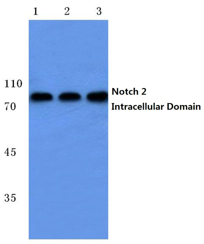 NOTCH2 (Cleaved Ala1734) Antibody in Western Blot (WB)