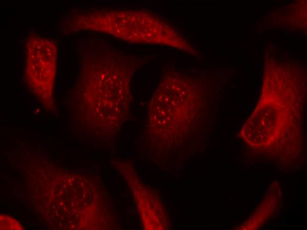 Phospho-FOXO3A (Ser253) Antibody in Immunocytochemistry (ICC/IF)