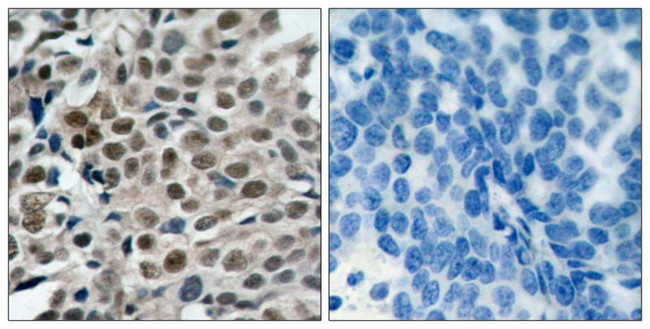 Phospho-FOXO3A (Ser253) Antibody in Immunohistochemistry (Paraffin) (IHC (P))