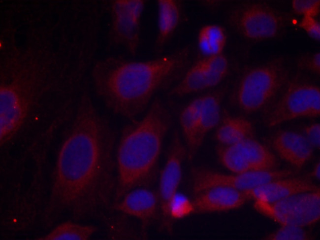 Phospho-NFkB p105 (Ser893) Antibody in Immunocytochemistry (ICC/IF)