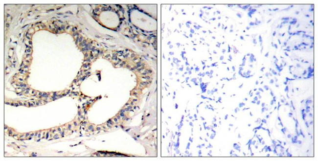 Phospho-IkB epsilon (Ser22) Antibody in Immunohistochemistry (Paraffin) (IHC (P))