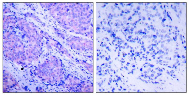 Phospho-PDPK1 (Ser241) Antibody in Immunohistochemistry (Paraffin) (IHC (P))