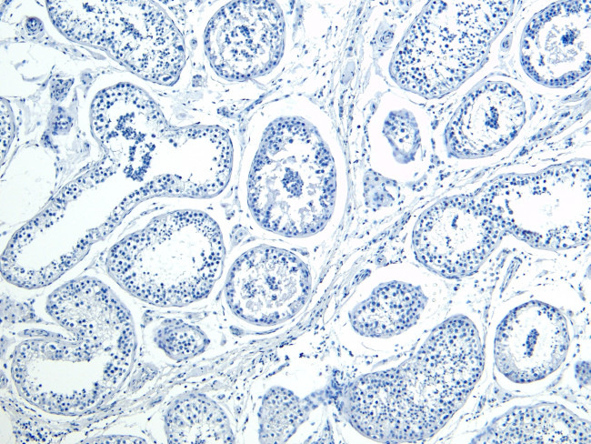 HOXA10 Antibody in Immunohistochemistry (Paraffin) (IHC (P))