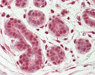 OAS2 Antibody in Immunohistochemistry (Paraffin) (IHC (P))