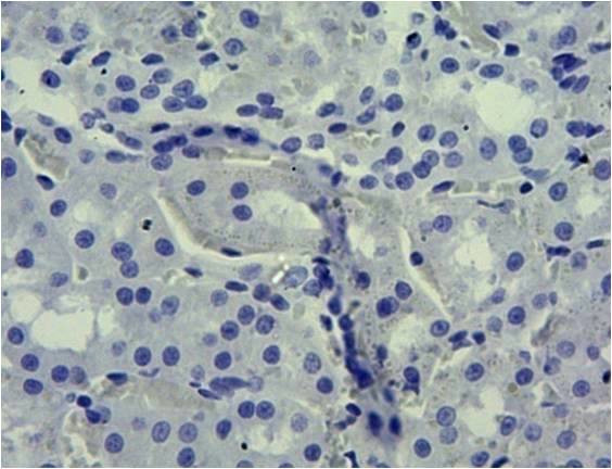 SGLT1 Antibody in Immunohistochemistry (Paraffin) (IHC (P))