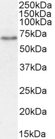 SGLT1 Antibody in Western Blot (WB)