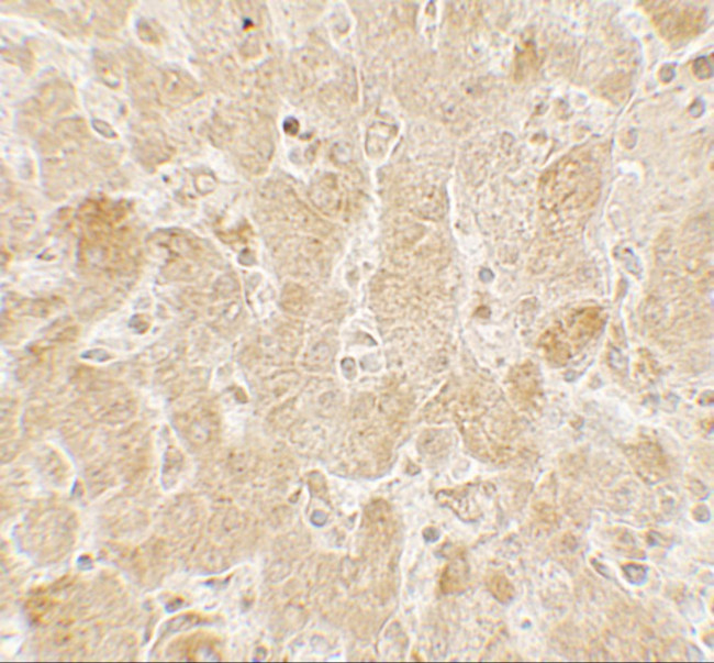 LAMTOR2 Antibody in Immunohistochemistry (Paraffin) (IHC (P))