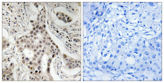 Phospho-SRC2 (Ser736) Antibody in Immunohistochemistry (Paraffin) (IHC (P))