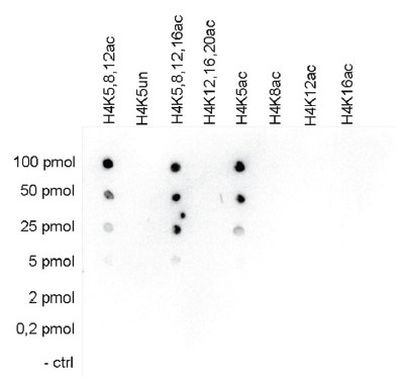 H4K5ac Antibody in Peptide array (ARRAY)