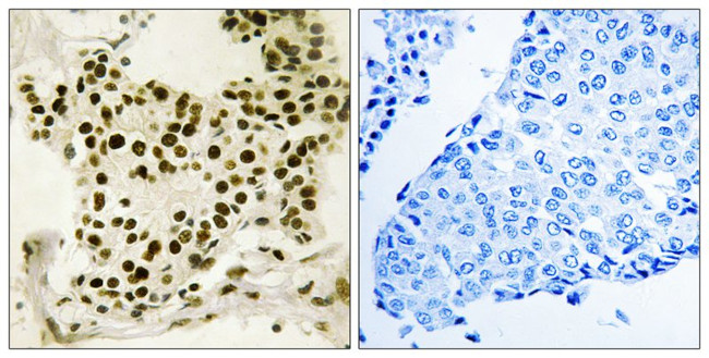 Phospho-UBF-1 (Ser484) Antibody in Immunohistochemistry (Paraffin) (IHC (P))