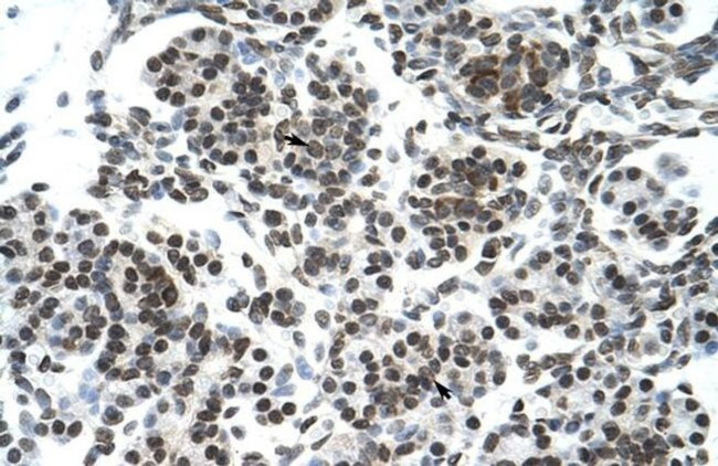 ZNF394 Antibody in Immunohistochemistry (Paraffin) (IHC (P))