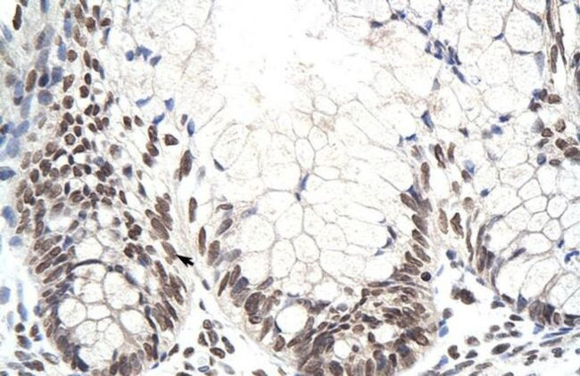 ZNF394 Antibody in Immunohistochemistry (Paraffin) (IHC (P))