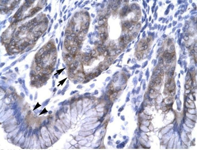 EAP30 Antibody in Immunohistochemistry (Paraffin) (IHC (P))