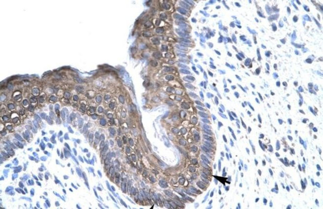 FOXE3 Antibody in Immunohistochemistry (IHC)