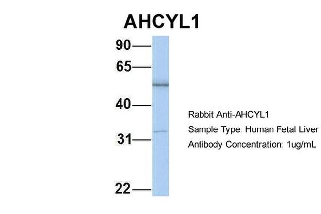 AdoHcyase 2 Antibody in Western Blot (WB)