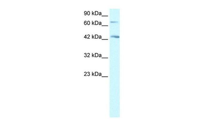 SEMA4A Antibody in Western Blot (WB)