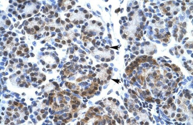 SPT5 Antibody in Immunohistochemistry (Paraffin) (IHC (P))