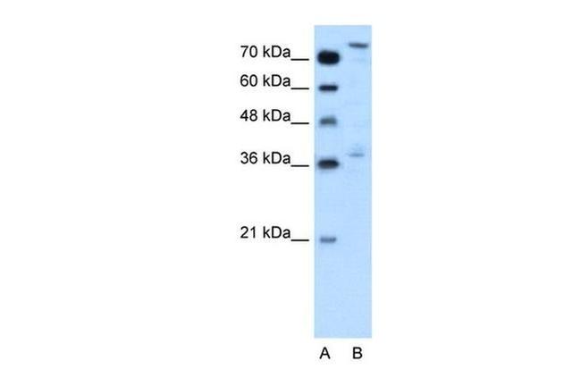 NFE2L3 Antibody in Western Blot (WB)