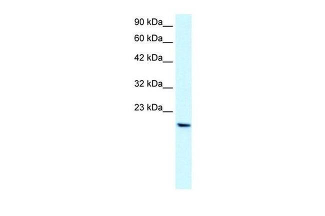 PTHLH Antibody in Western Blot (WB)