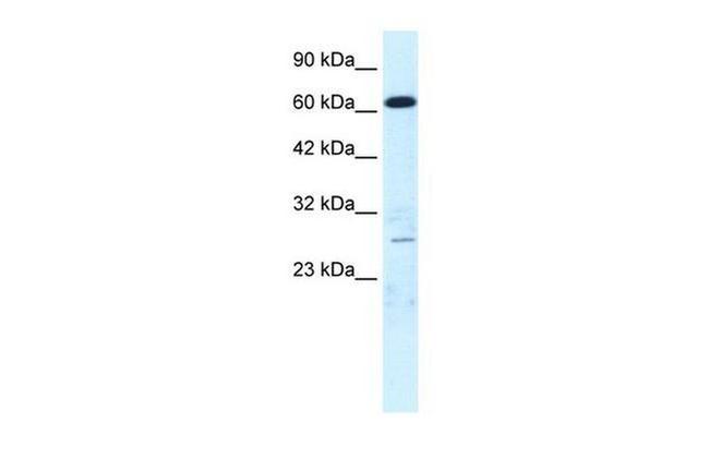 MED17 Antibody in Western Blot (WB)