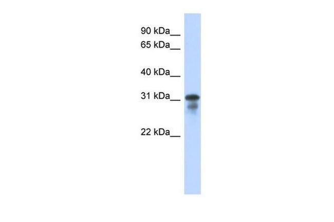 MED6 Antibody in Western Blot (WB)