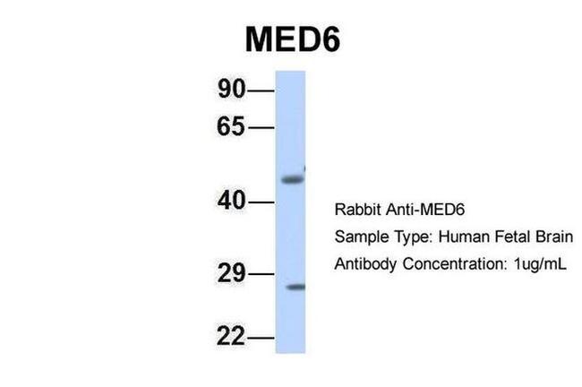 MED6 Antibody in Western Blot (WB)