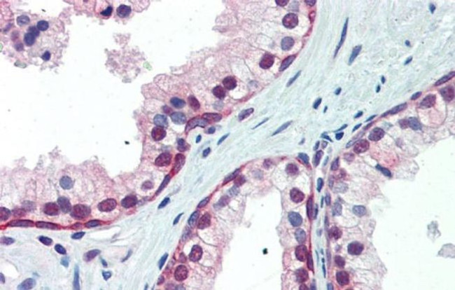 NRF1 Antibody in Immunohistochemistry (Paraffin) (IHC (P))