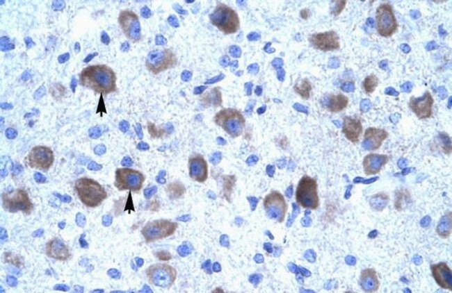 KCNIP4 Antibody in Immunohistochemistry (IHC)