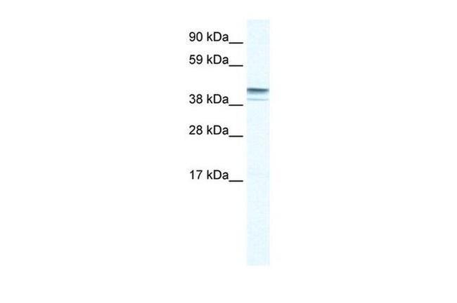 ZNF627 Antibody in Western Blot (WB)