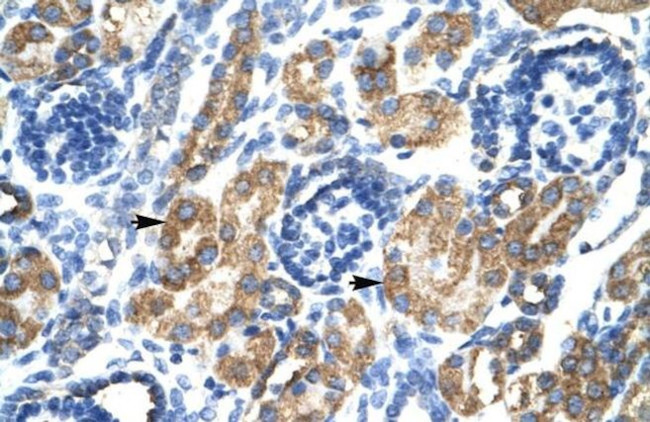 HSF2BP Antibody in Immunohistochemistry (IHC)