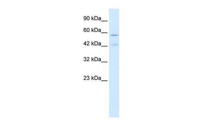 CHRNA5 Antibody in Western Blot (WB)