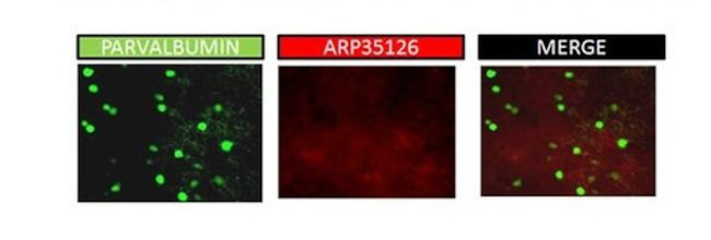 KVbeta1 (KCNAB1) Antibody in Immunohistochemistry (IHC)