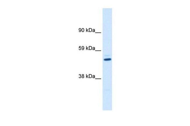 KVbeta1 (KCNAB1) Antibody in Western Blot (WB)