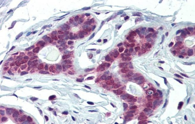 FUBP1 Antibody in Immunohistochemistry (IHC)