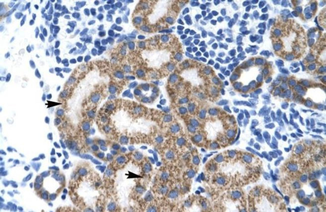 TBPL1 Antibody in Immunohistochemistry (IHC)