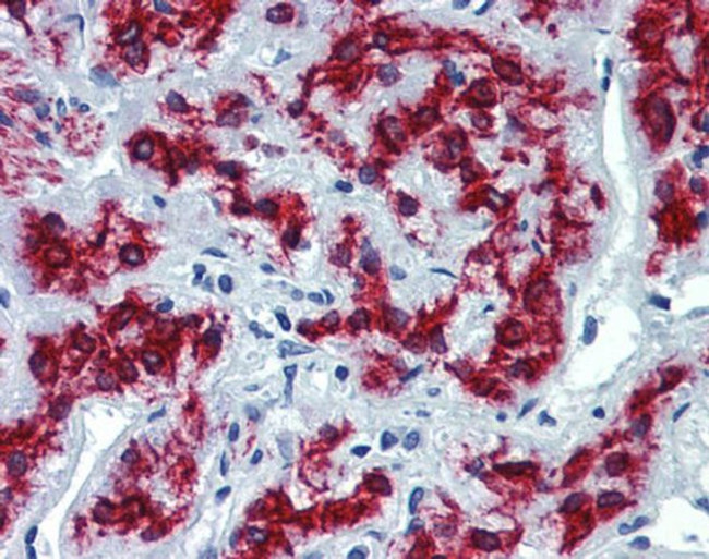 VEZF1 Antibody in Immunohistochemistry (Paraffin) (IHC (P))