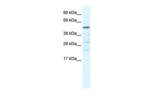 HSFY1 Antibody in Western Blot (WB)