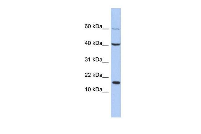 ATOH7 Antibody in Western Blot (WB)