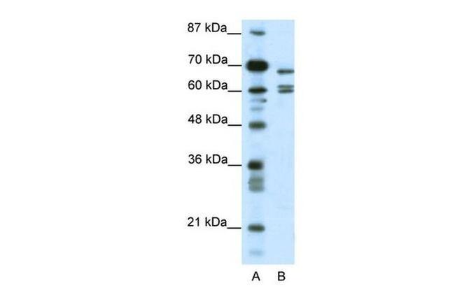 KCNK5 Antibody in Western Blot (WB)