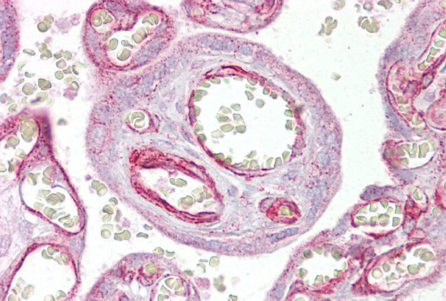 GRHL3 Antibody in Immunohistochemistry (IHC)