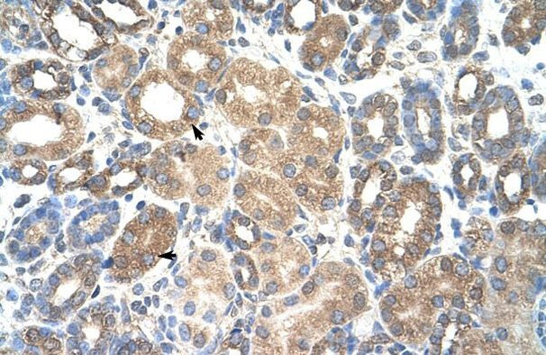 HSPBAP1 Antibody in Immunohistochemistry (IHC)