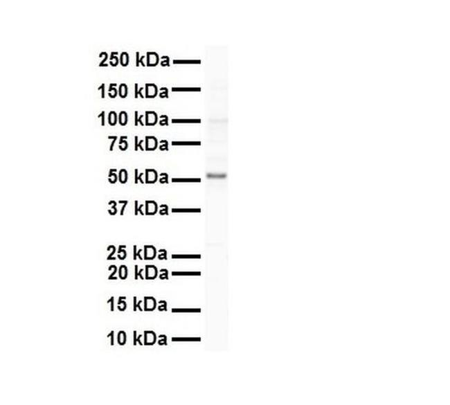 SNRNP70 Antibody in Western Blot (WB)