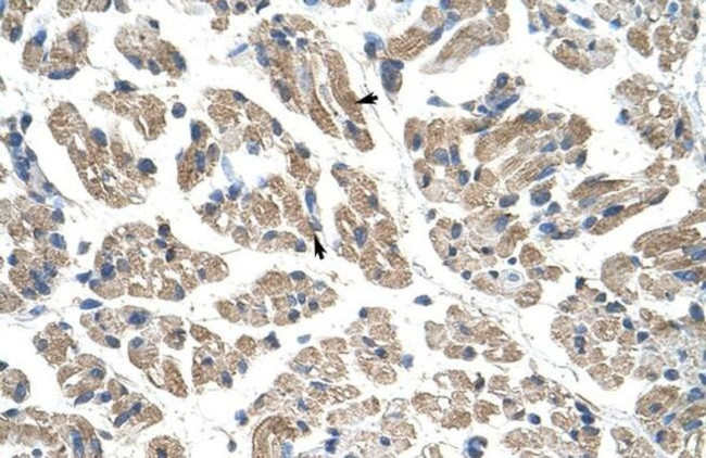 GTPBP9 Antibody in Immunohistochemistry (Paraffin) (IHC (P))