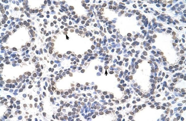 CARS Antibody in Immunohistochemistry (Paraffin) (IHC (P))