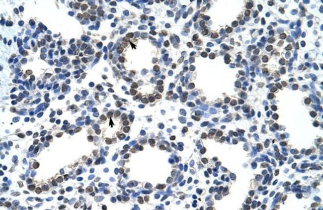 CARS Antibody in Immunohistochemistry (Paraffin) (IHC (P))